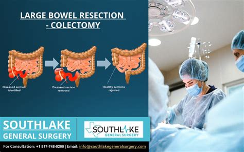 Risks specific to small bowel surgery include. . 6 months after bowel resection